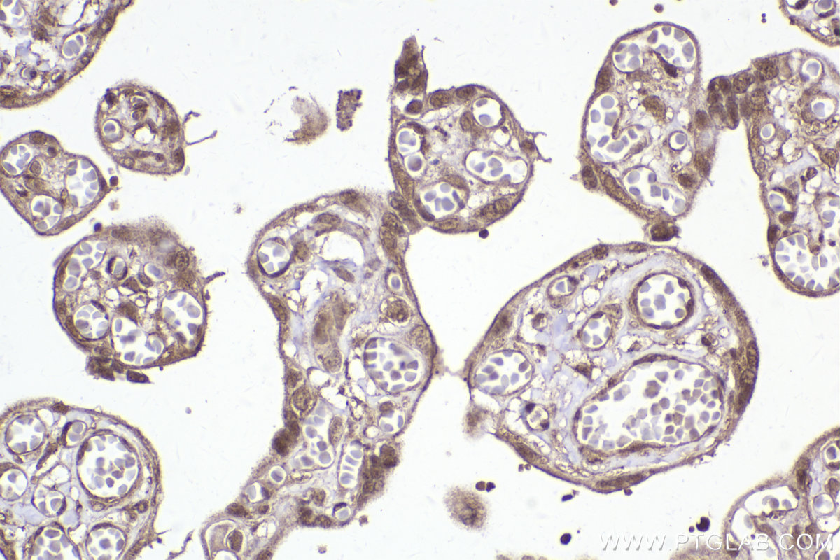 Immunohistochemistry (IHC) staining of human placenta tissue using IRAK1 Polyclonal antibody (10478-2-AP)