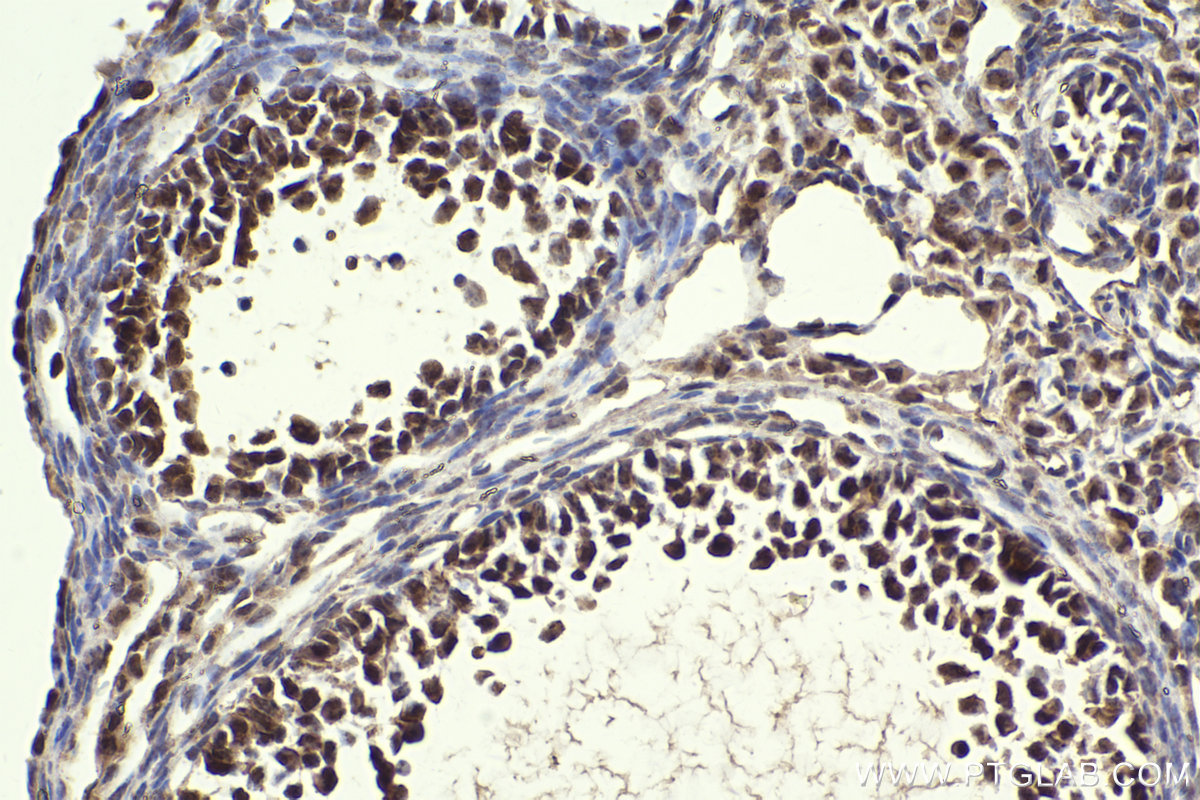 Immunohistochemistry (IHC) staining of mouse ovary tissue using IRAK1 Polyclonal antibody (10478-2-AP)