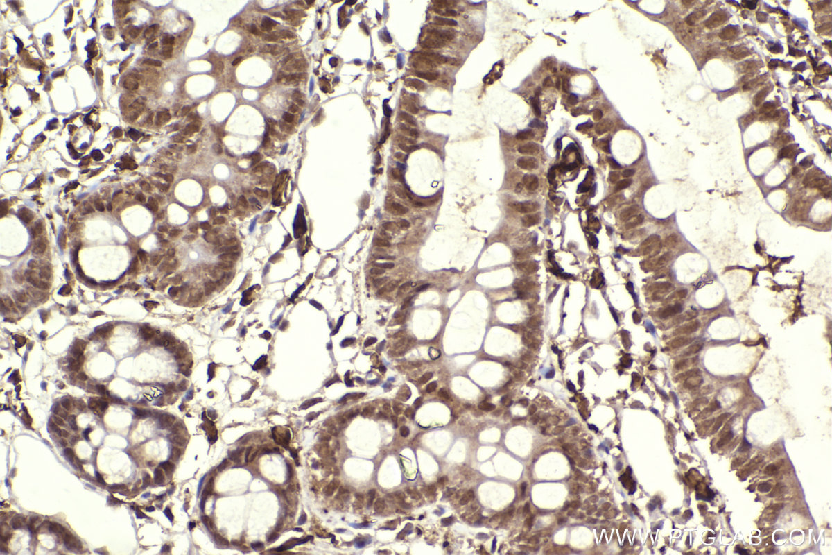 Immunohistochemistry (IHC) staining of rat intestine using IRAK1 Polyclonal antibody (10478-2-AP)