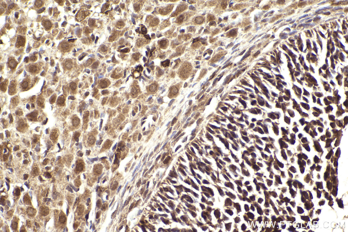 Immunohistochemistry (IHC) staining of rat ovary tissue using IRAK1 Polyclonal antibody (10478-2-AP)