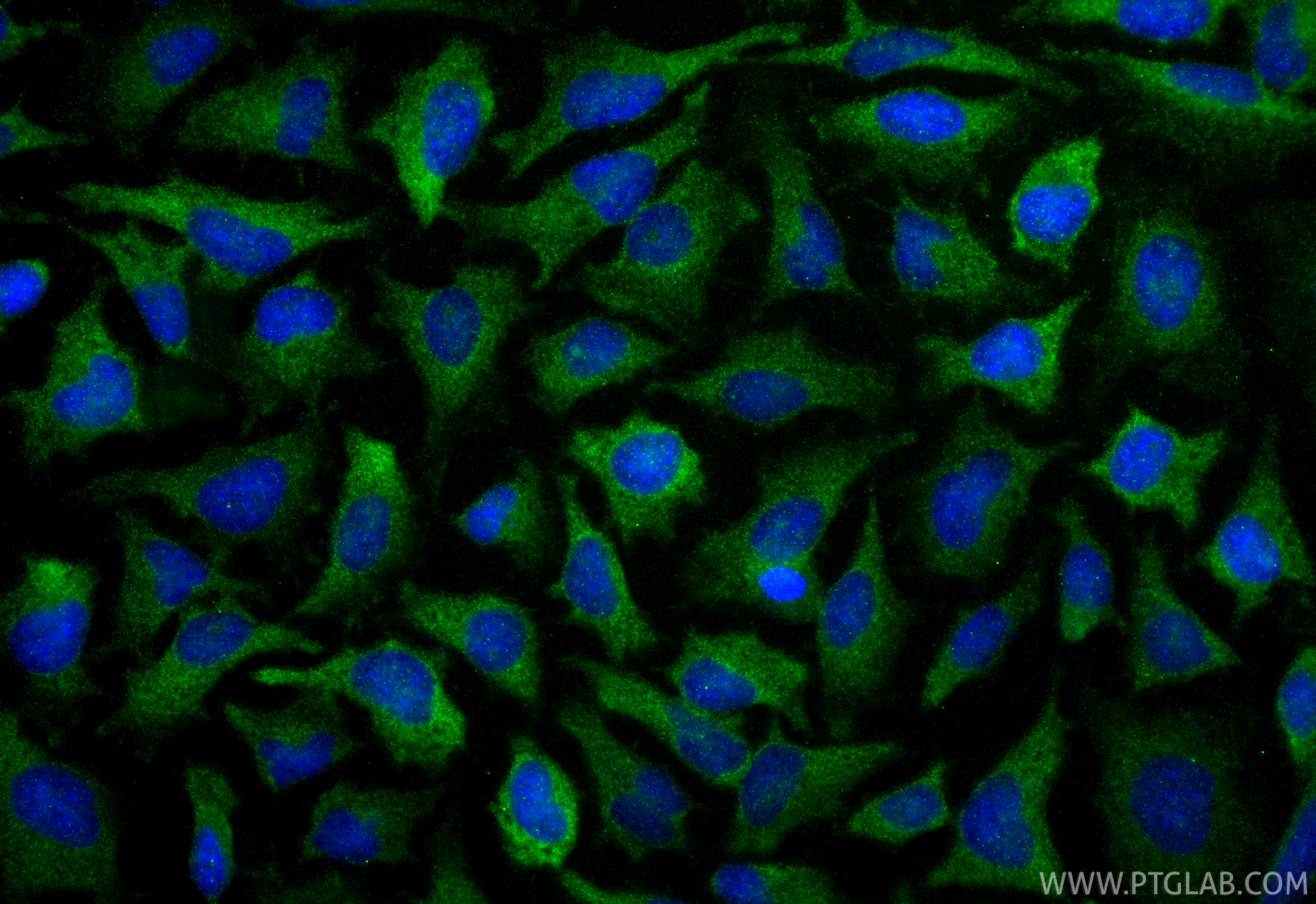 Immunofluorescence (IF) / fluorescent staining of HeLa cells using IRAK1 Recombinant antibody (86068-3-RR)