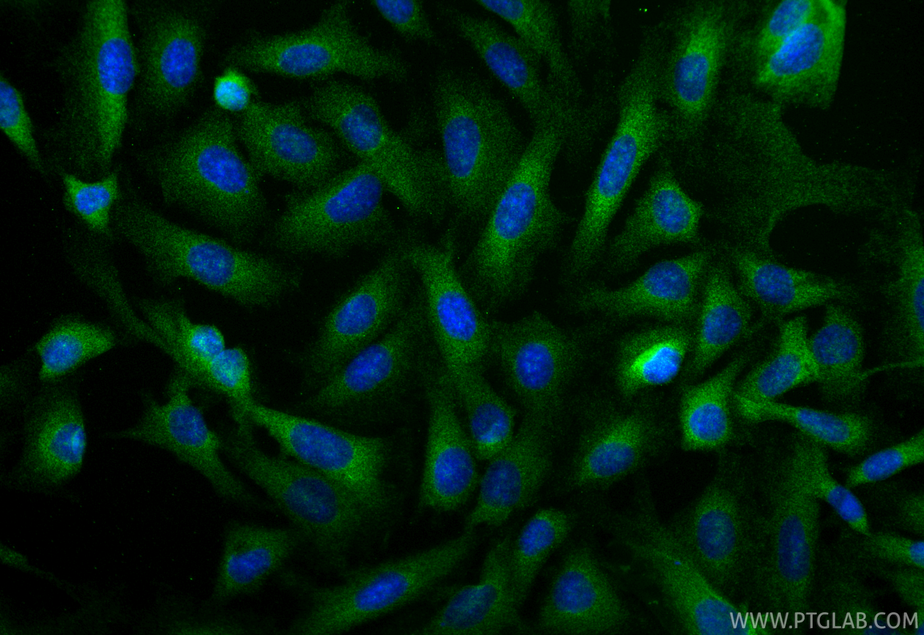 Immunofluorescence (IF) / fluorescent staining of SKOV-3 cells using IRAK1 Recombinant antibody (86068-3-RR)