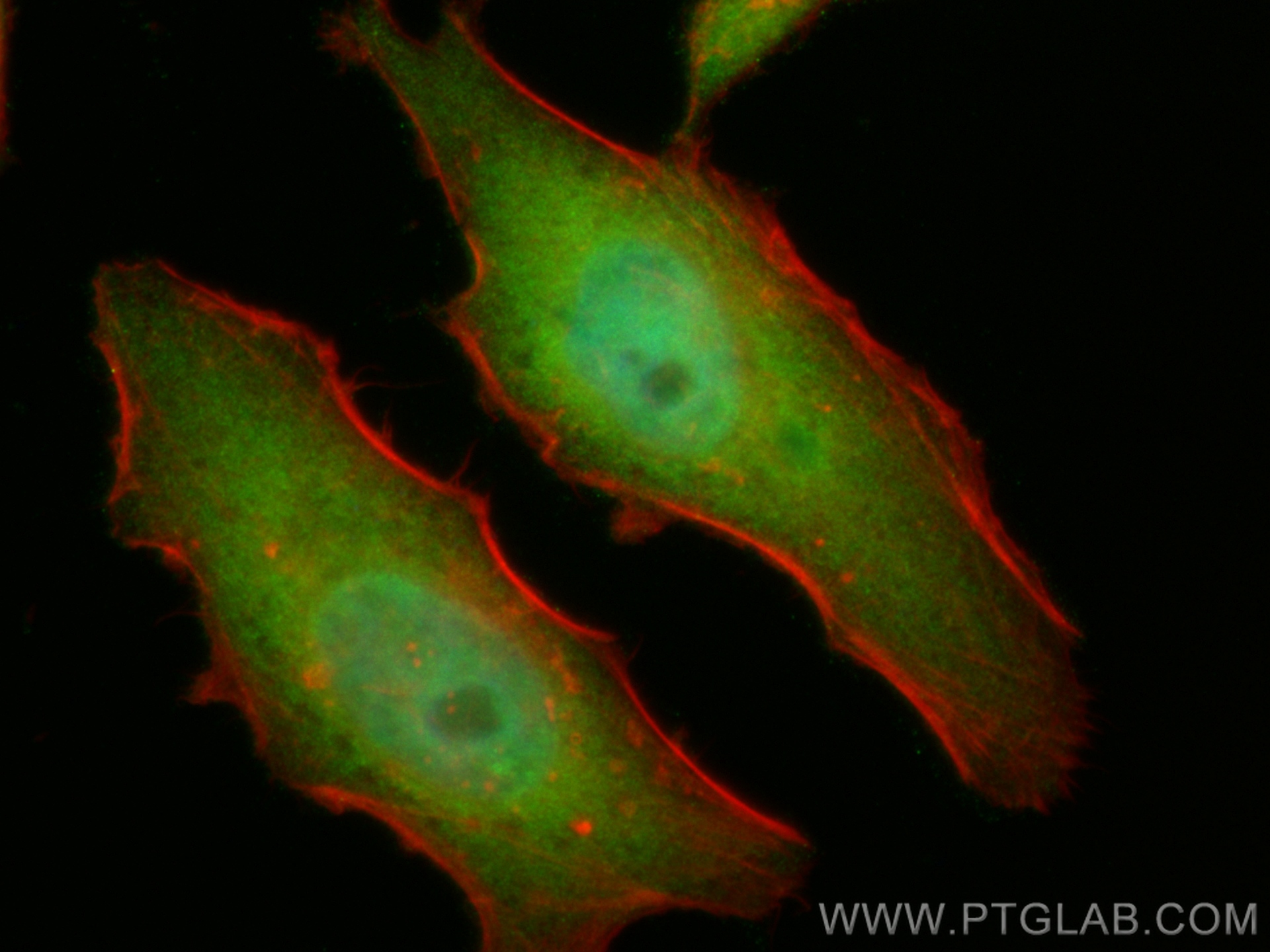 Immunofluorescence (IF) / fluorescent staining of HeLa cells using CoraLite® Plus 488-conjugated IRAK1 Polyclonal ant (CL488-10478)