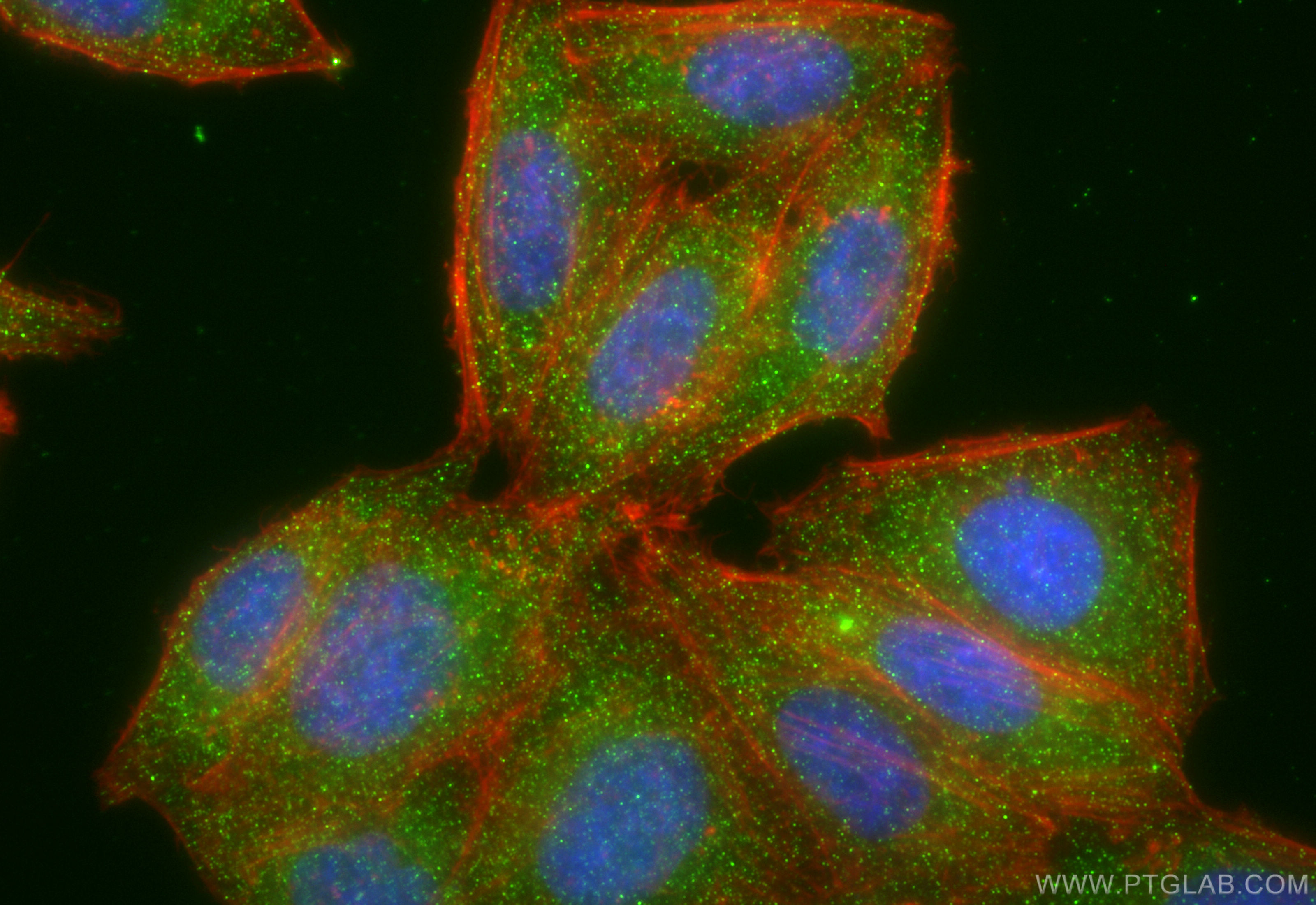 Immunofluorescence (IF) / fluorescent staining of HepG2 cells using IRAK4 Monoclonal antibody (67180-1-Ig)