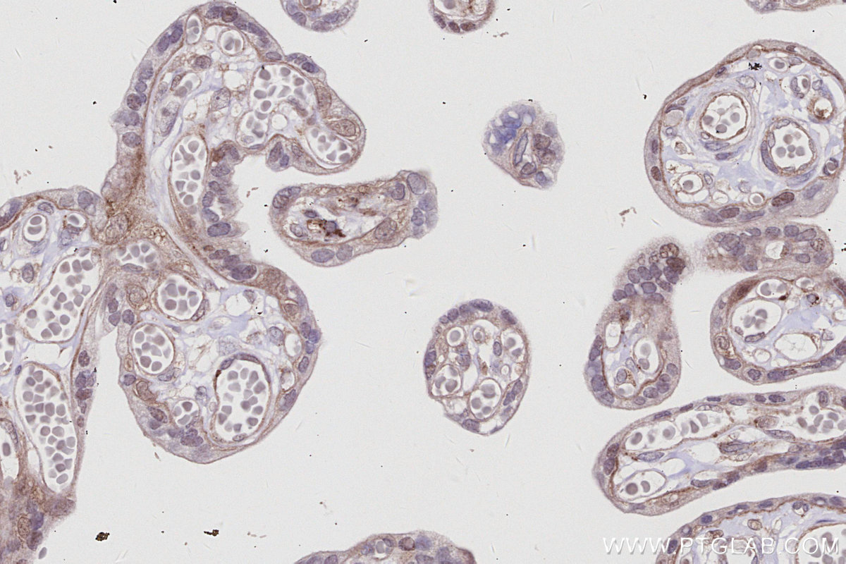 Immunohistochemistry (IHC) staining of human placenta tissue using IRAK4 Monoclonal antibody (67180-1-Ig)