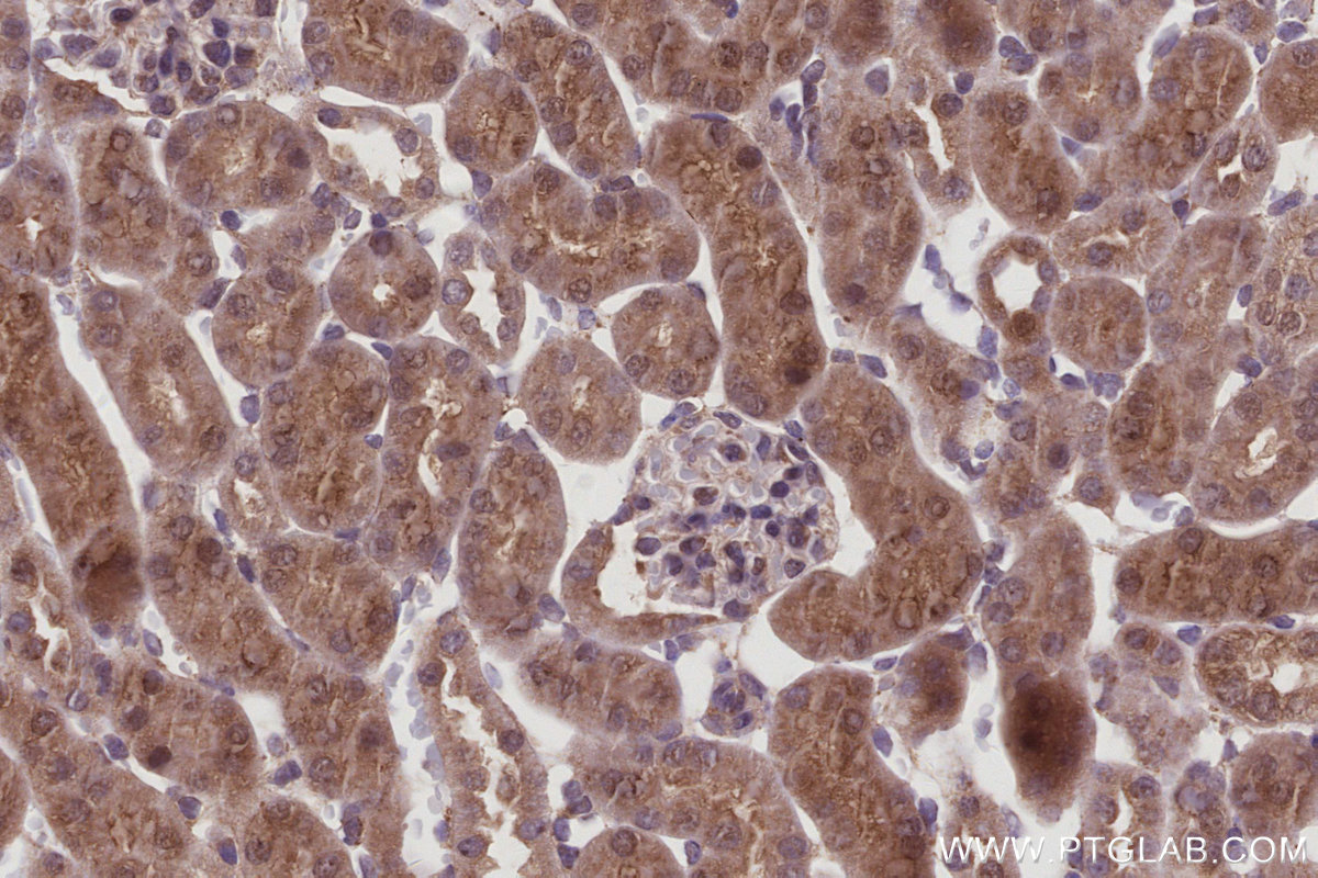 Immunohistochemistry (IHC) staining of mouse kidney tissue using IRAK4 Monoclonal antibody (67180-1-Ig)