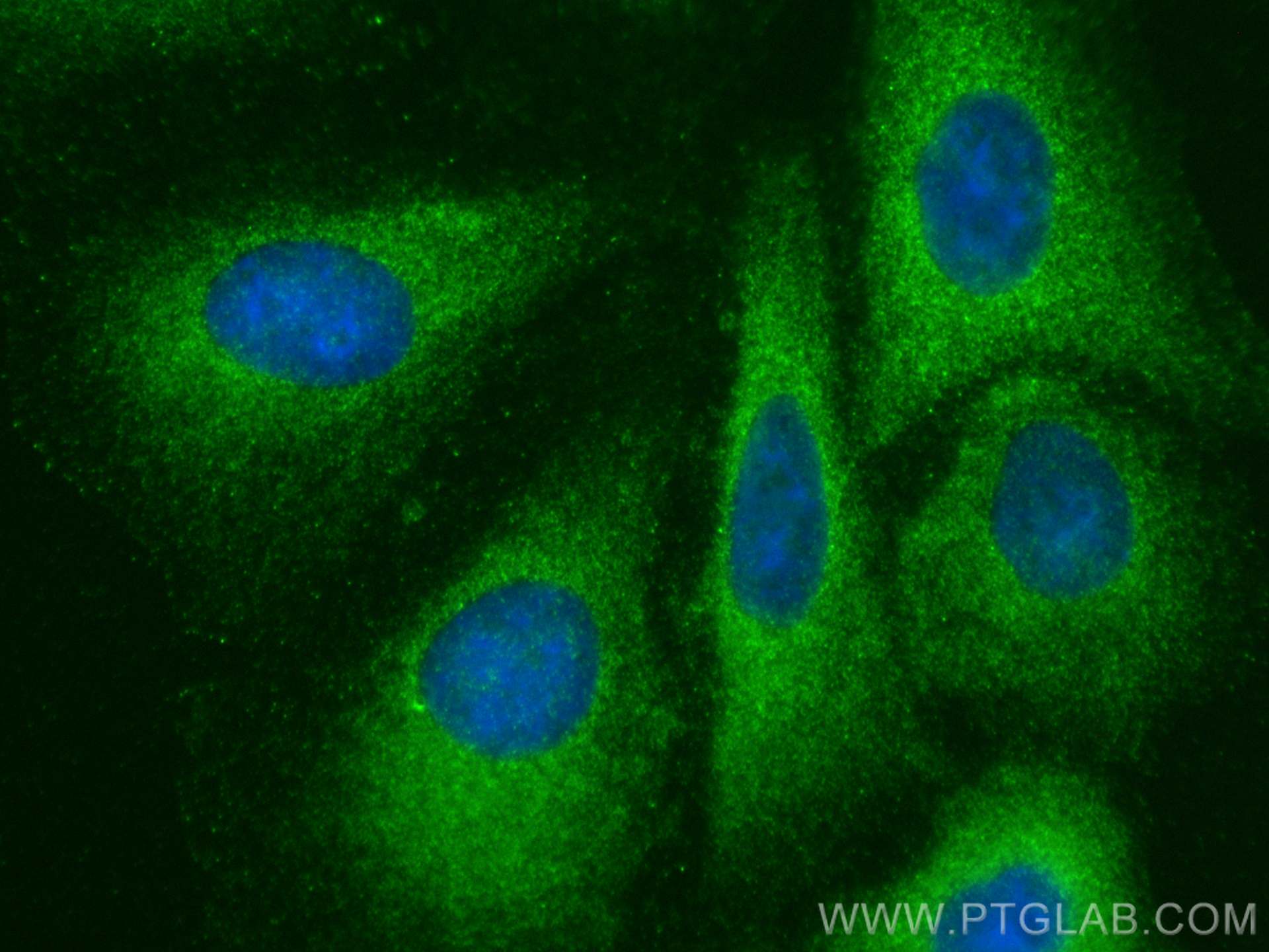 Immunofluorescence (IF) / fluorescent staining of A549 cells using IREB2 Polyclonal antibody (29976-1-AP)