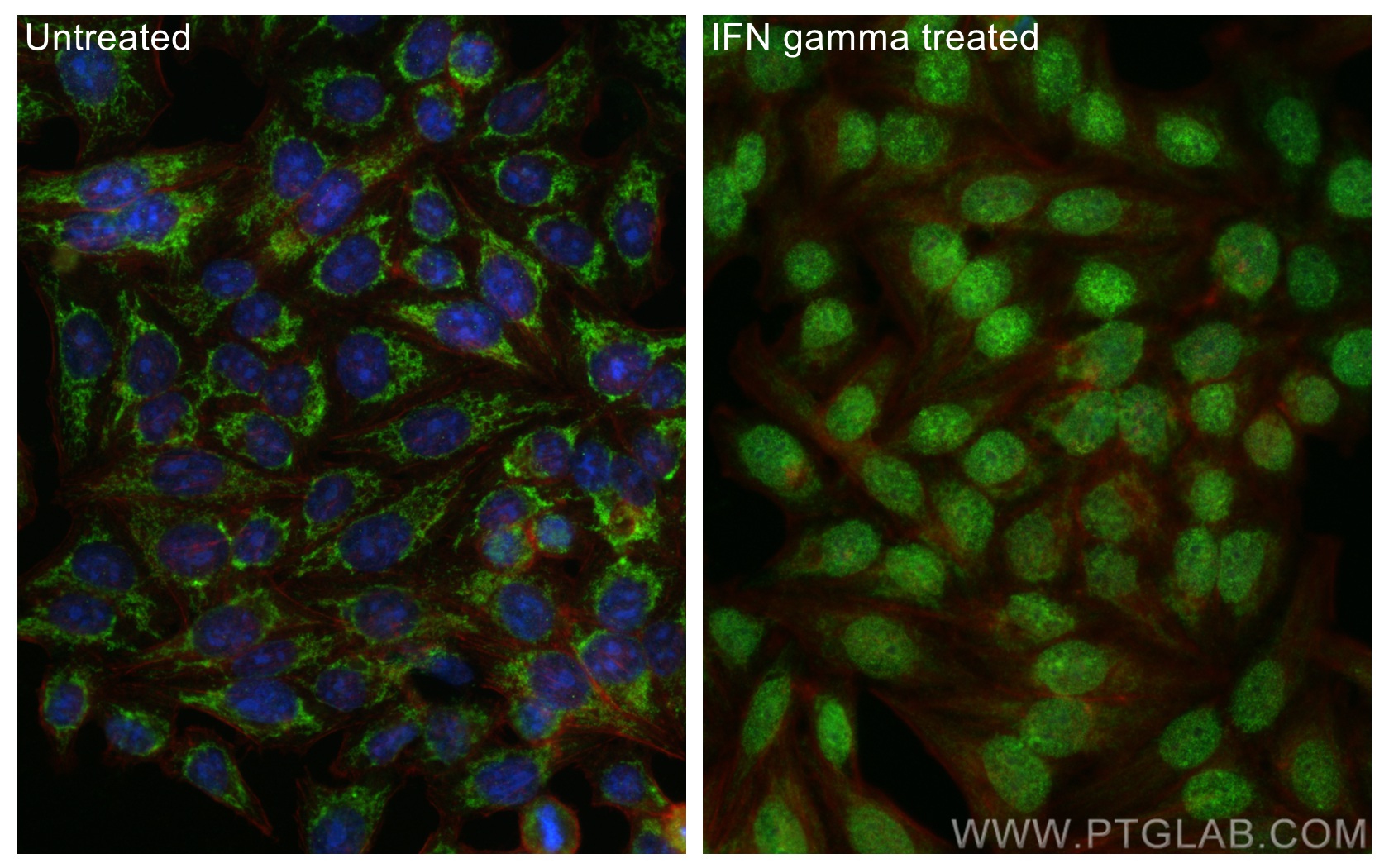 Immunofluorescence (IF) / fluorescent staining of HepG2 cells using IRF1 Polyclonal antibody (11335-1-AP)