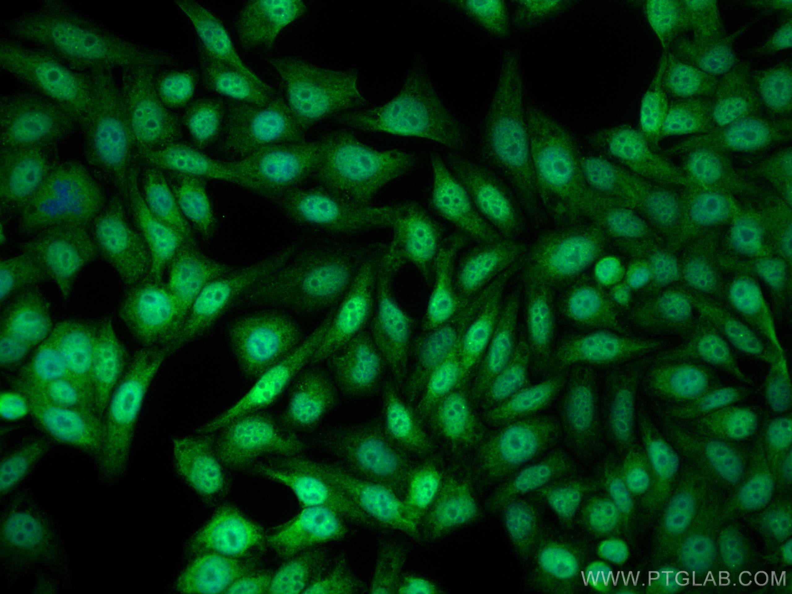 Immunofluorescence (IF) / fluorescent staining of HepG2 cells using IRF2BP2 Polyclonal antibody (18847-1-AP)