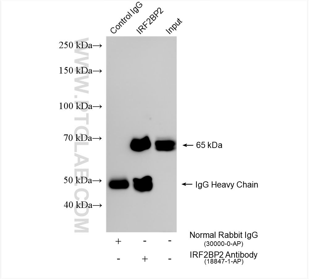 Immunoprecipitation (IP) experiment of K-562 cells using IRF2BP2 Polyclonal antibody (18847-1-AP)