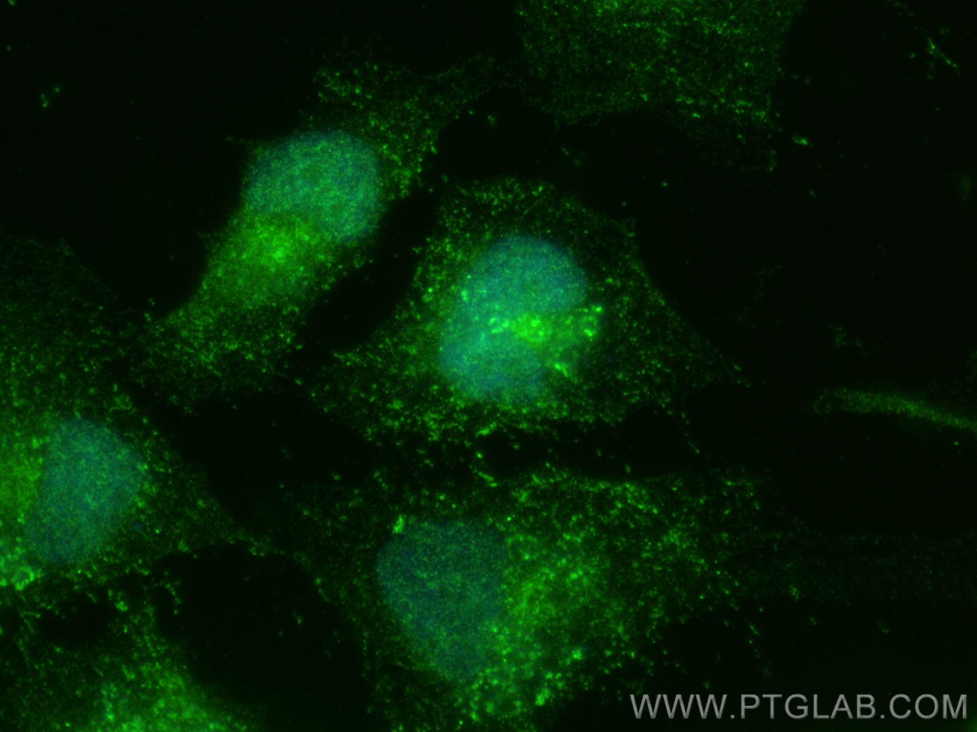 Immunofluorescence (IF) / fluorescent staining of HeLa cells using IRF3 Polyclonal antibody (11312-1-AP)