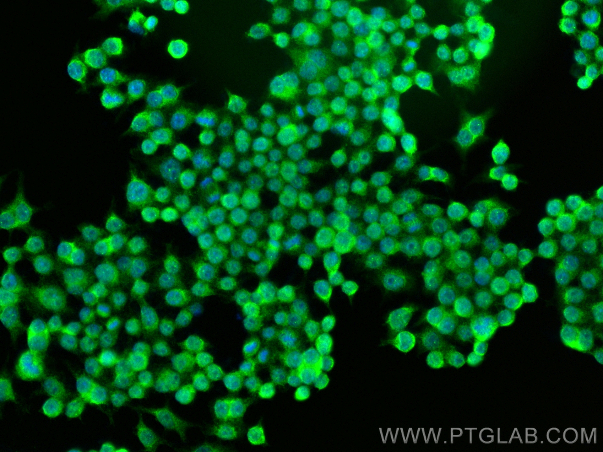 Immunofluorescence (IF) / fluorescent staining of RAW 264.7 cells using MUM1/IRF4 Polyclonal antibody (11247-2-AP)