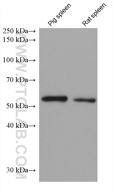 Western Blot (WB) analysis of various lysates using IRF4 Monoclonal antibody (66451-1-Ig)