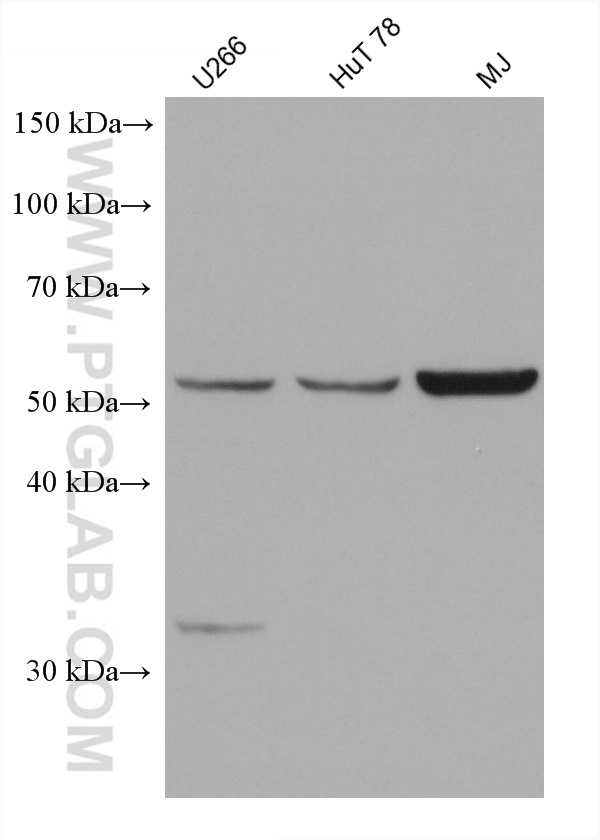 Western Blot (WB) analysis of various lysates using IRF4 Monoclonal antibody (66451-1-Ig)