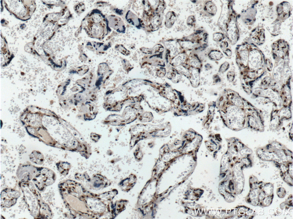 Immunohistochemistry (IHC) staining of human placenta tissue using IRF5 Monoclonal antibody (60088-1-Ig)