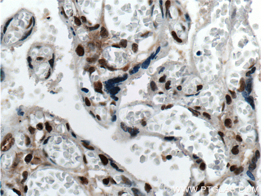 Immunohistochemistry (IHC) staining of human placenta tissue using IRF5 Monoclonal antibody (60088-1-Ig)