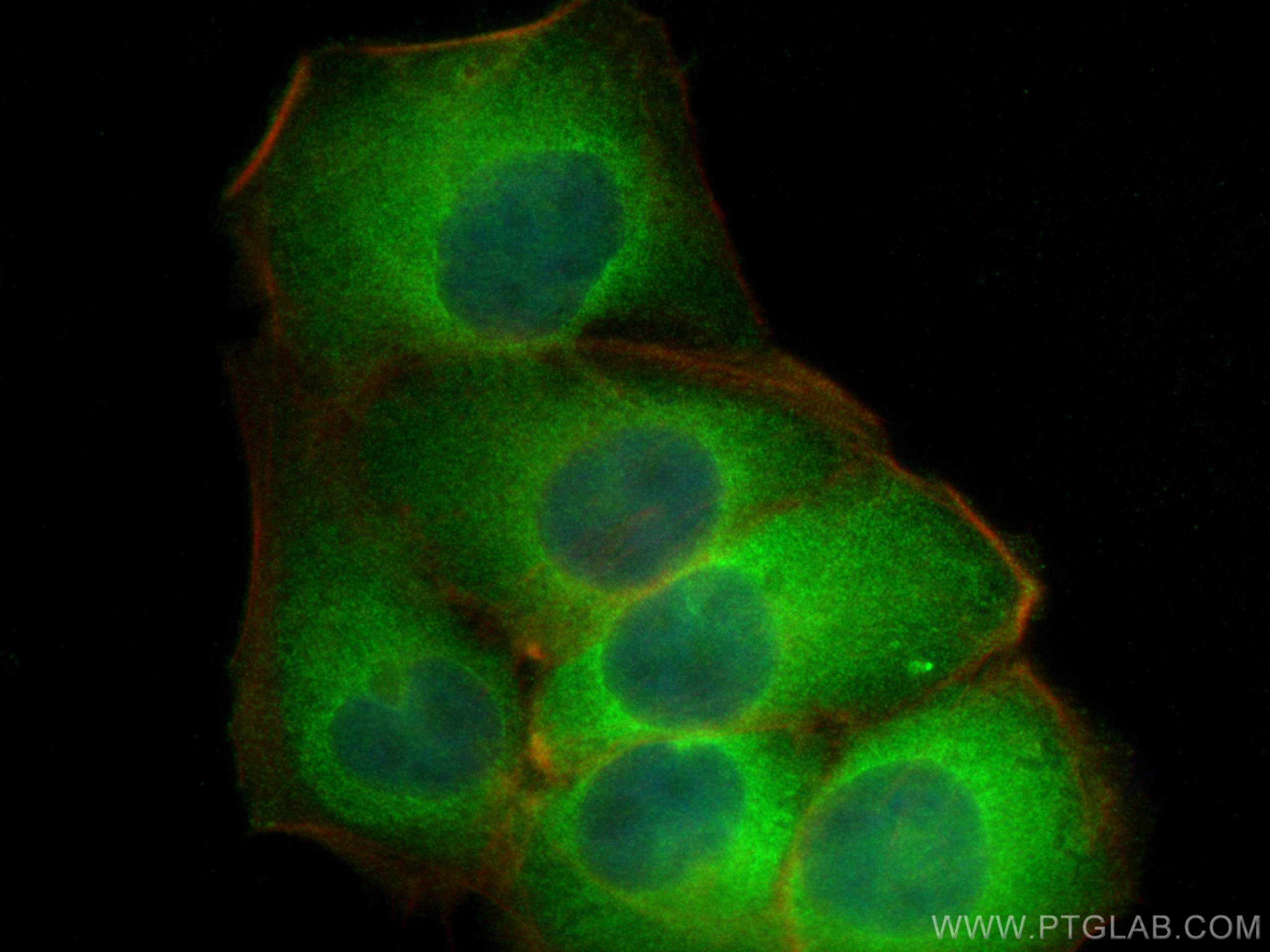 Immunofluorescence (IF) / fluorescent staining of HaCaT cells using IRF6 Polyclonal antibody (12928-1-AP)