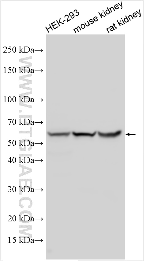 Western Blot (WB) analysis of various lysates using IRF7 Polyclonal antibody (22392-1-AP)