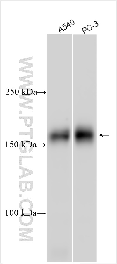 Western Blot (WB) analysis of various lysates using IRS1 Polyclonal antibody (17509-1-AP)