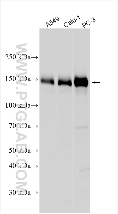 Western Blot (WB) analysis of various lysates using IRS1 Polyclonal antibody (17509-1-AP)