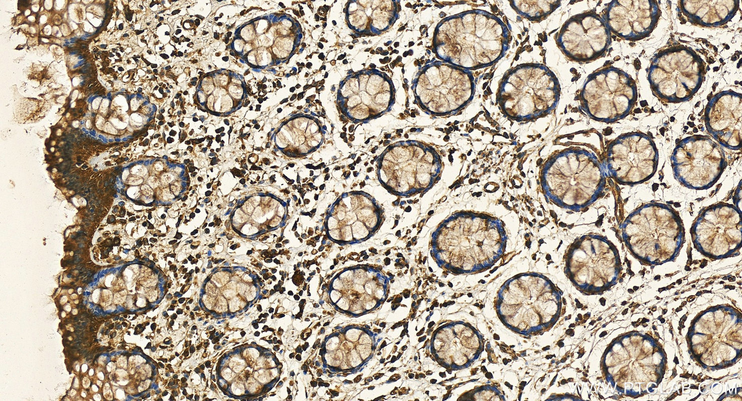 Immunohistochemistry (IHC) staining of human colon tissue using IRS1 Recombinant antibody (82730-10-RR)