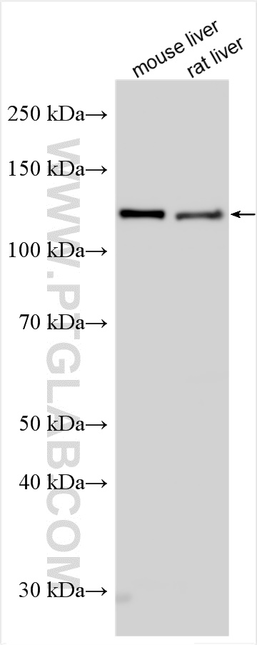 Western Blot (WB) analysis of various lysates using IRS4 Polyclonal antibody (31012-1-AP)