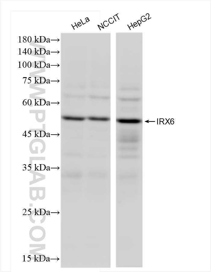 Western Blot (WB) analysis of various lysates using IRX6 Recombinant antibody (83800-5-RR)