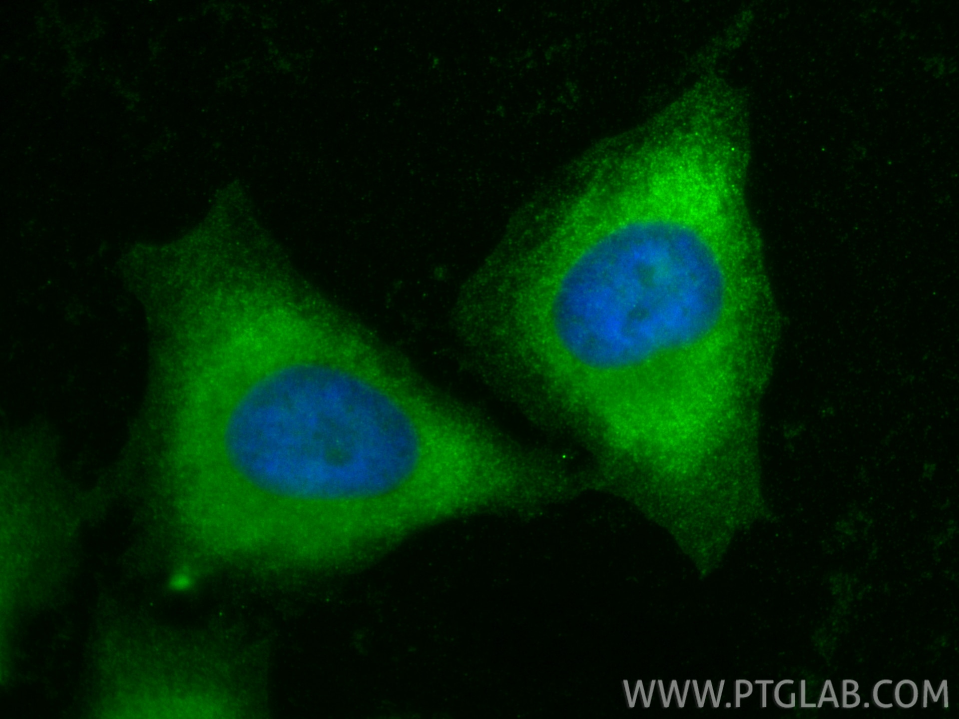 Immunofluorescence (IF) / fluorescent staining of HeLa cells using ISG15 Polyclonal antibody (15981-1-AP)