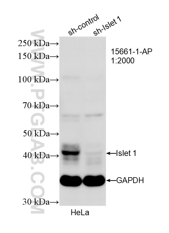 Western Blot (WB) analysis of HeLa cells using Islet 1 Polyclonal antibody (15661-1-AP)