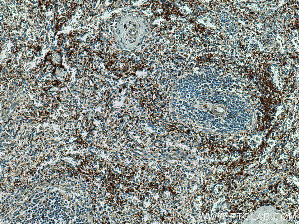 Immunohistochemistry (IHC) staining of human spleen tissue using CD41/Integrin alpha 2b Polyclonal antibody (18308-1-AP)