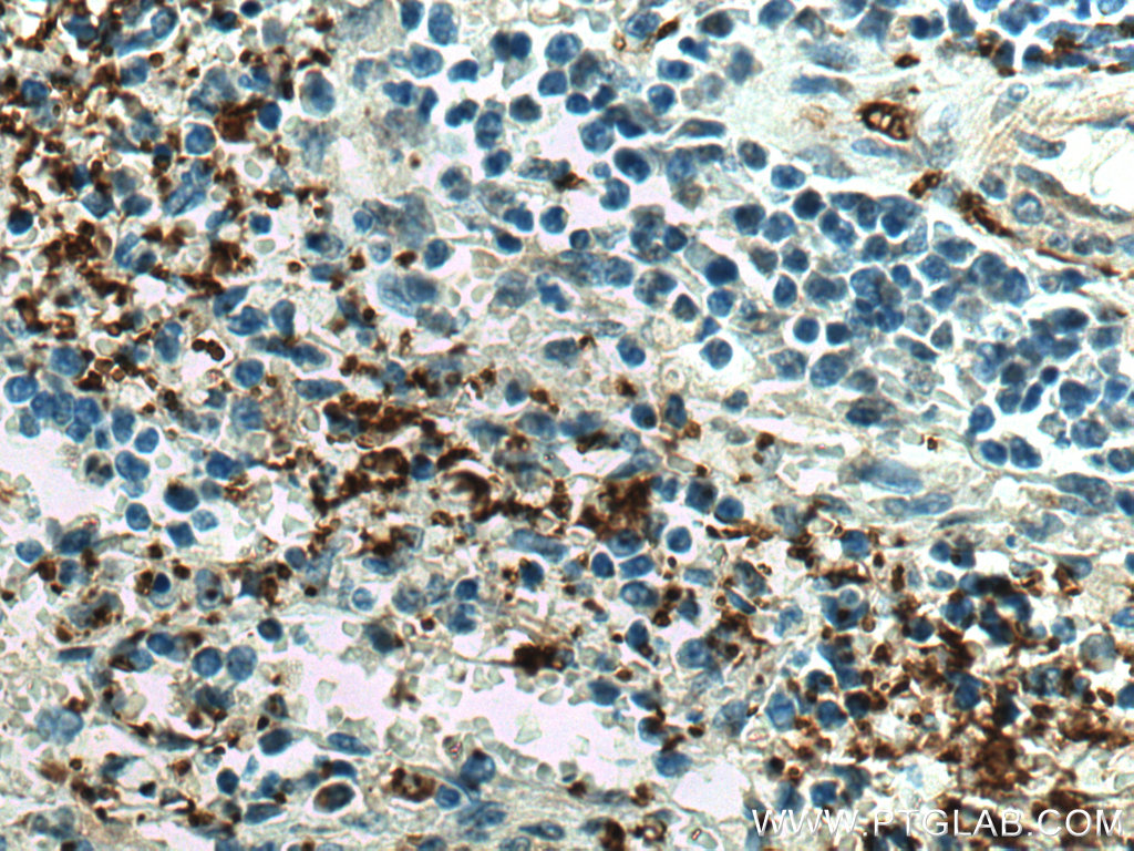 Immunohistochemistry (IHC) staining of human spleen tissue using CD41/Integrin alpha 2b Polyclonal antibody (18308-1-AP)