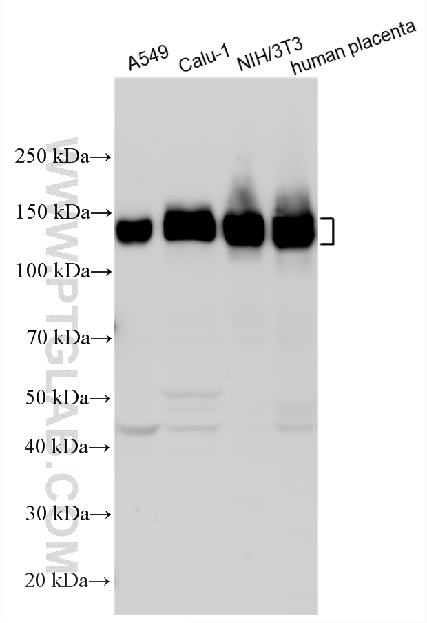Western Blot (WB) analysis of various lysates using Integrin alpha-5/CD49e Polyclonal antibody (10569-1-AP)