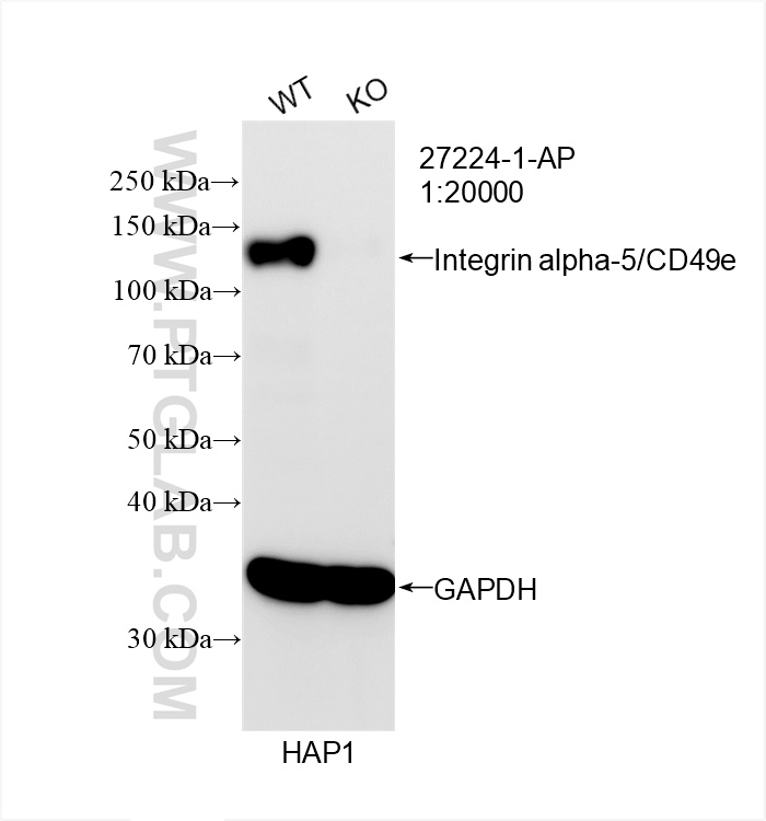 Western Blot (WB) analysis of HAP1 cells using Integrin alpha-5/CD49e Polyclonal antibody (27224-1-AP)
