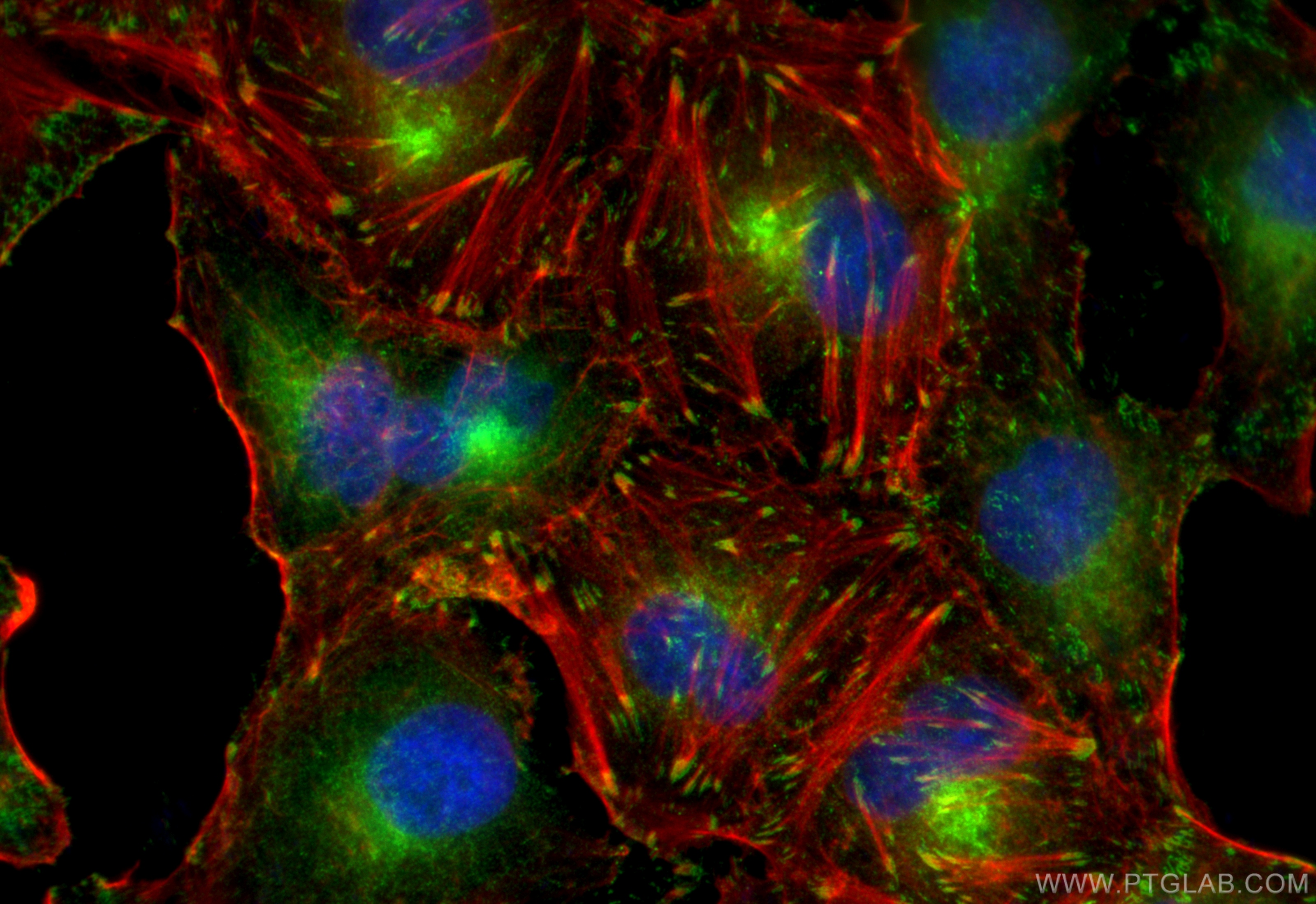 Immunofluorescence (IF) / fluorescent staining of A549 cells using Integrin Alpha V Polyclonal antibody (27096-1-AP)