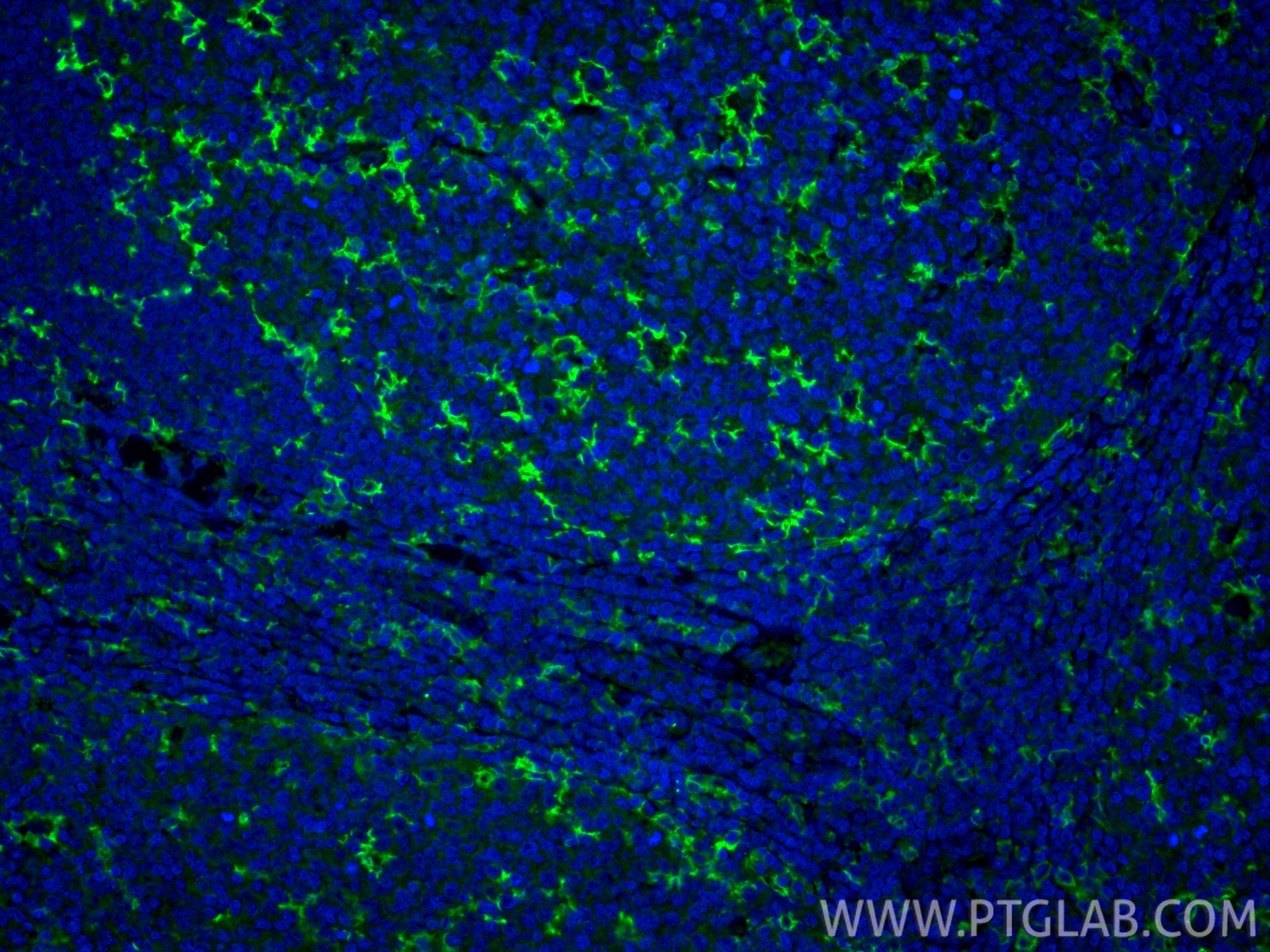 Immunofluorescence (IF) / fluorescent staining of human tonsillitis tissue using CD11c Polyclonal antibody (17342-1-AP)