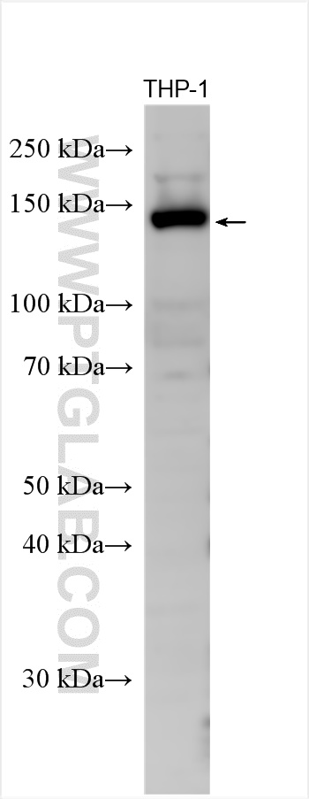 Western Blot (WB) analysis of various lysates using CD11c/Integrin Alpha X Polyclonal antibody (17342-1-AP)