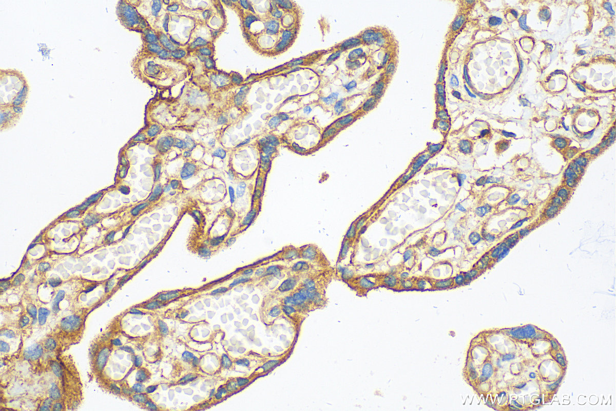 Immunohistochemistry (IHC) staining of human placenta tissue using Integrin Beta 1 Polyclonal antibody (12594-1-AP)