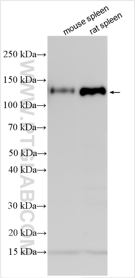 Western Blot (WB) analysis of various lysates using Integrin Beta 1 Polyclonal antibody (12594-1-AP)