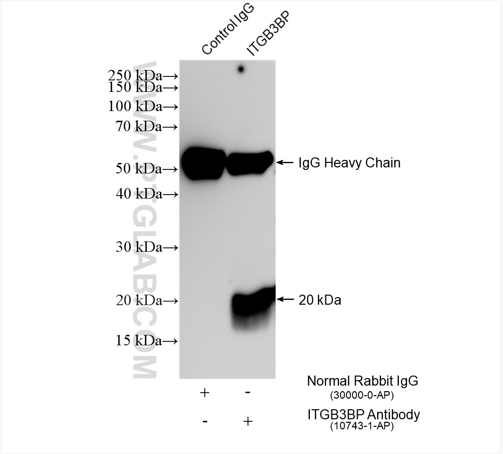 Immunoprecipitation (IP) experiment of K-562 cells using Centromere protein R Polyclonal antibody (10743-1-AP)