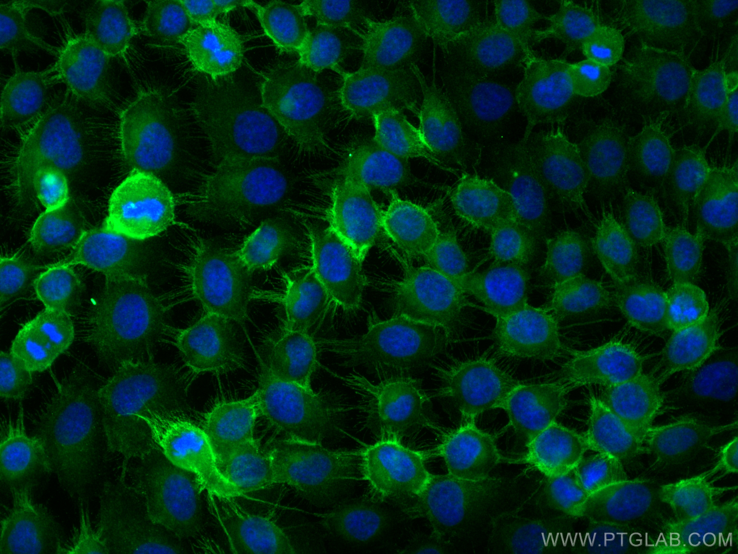 Immunofluorescence (IF) / fluorescent staining of A431 cells using Integrin Beta 4 Polyclonal antibody (21738-1-AP)