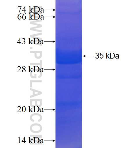 ITIH4 fusion protein Ag21276 SDS-PAGE