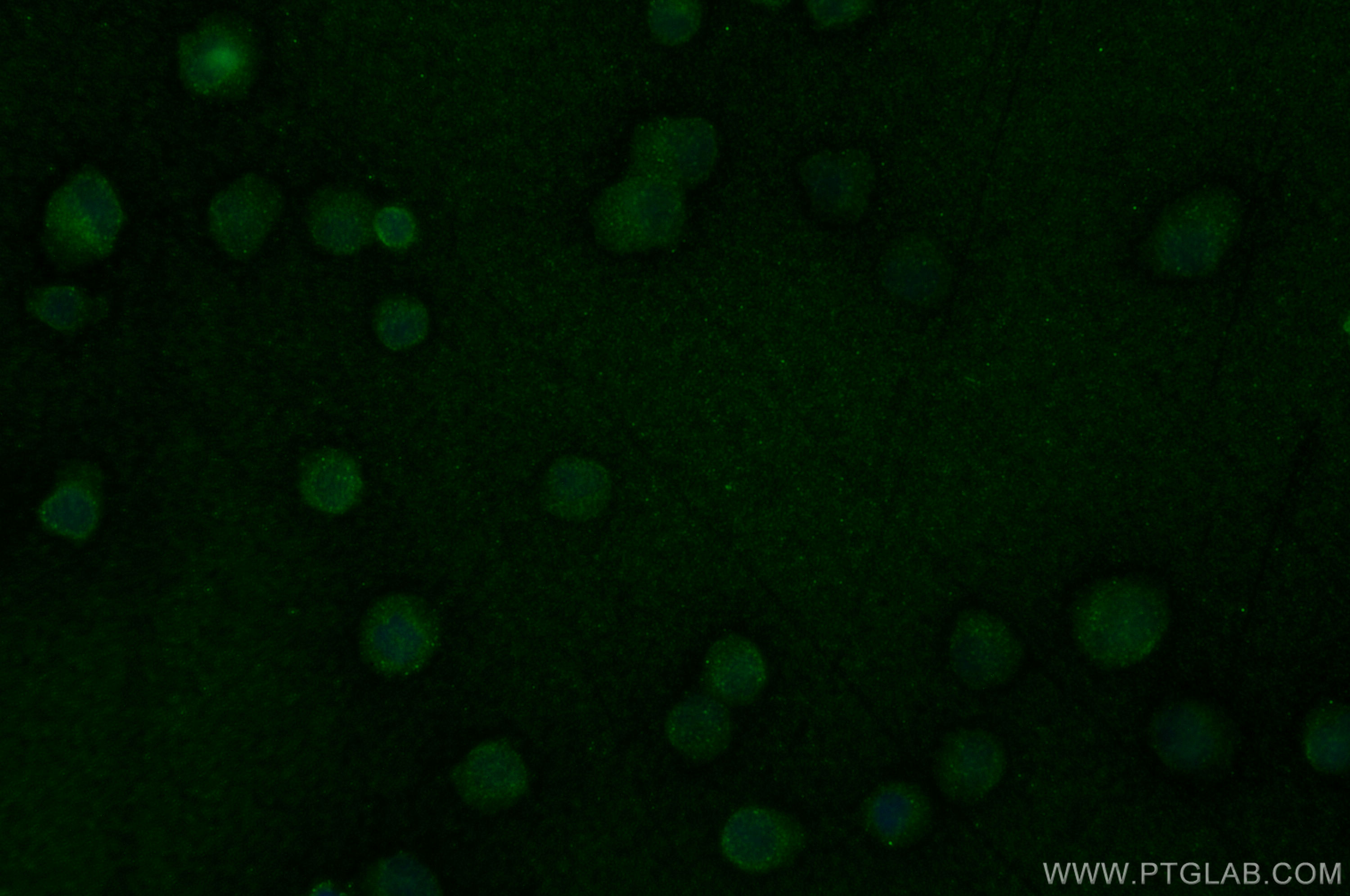 Immunofluorescence (IF) / fluorescent staining of Jurkat cells using ITK Polyclonal antibody (21525-1-AP)