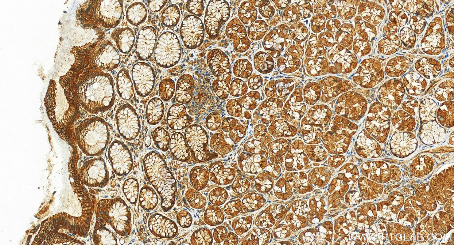 Immunohistochemistry (IHC) staining of human stomach tissue using Intersectin 1 Polyclonal antibody (21862-1-AP)