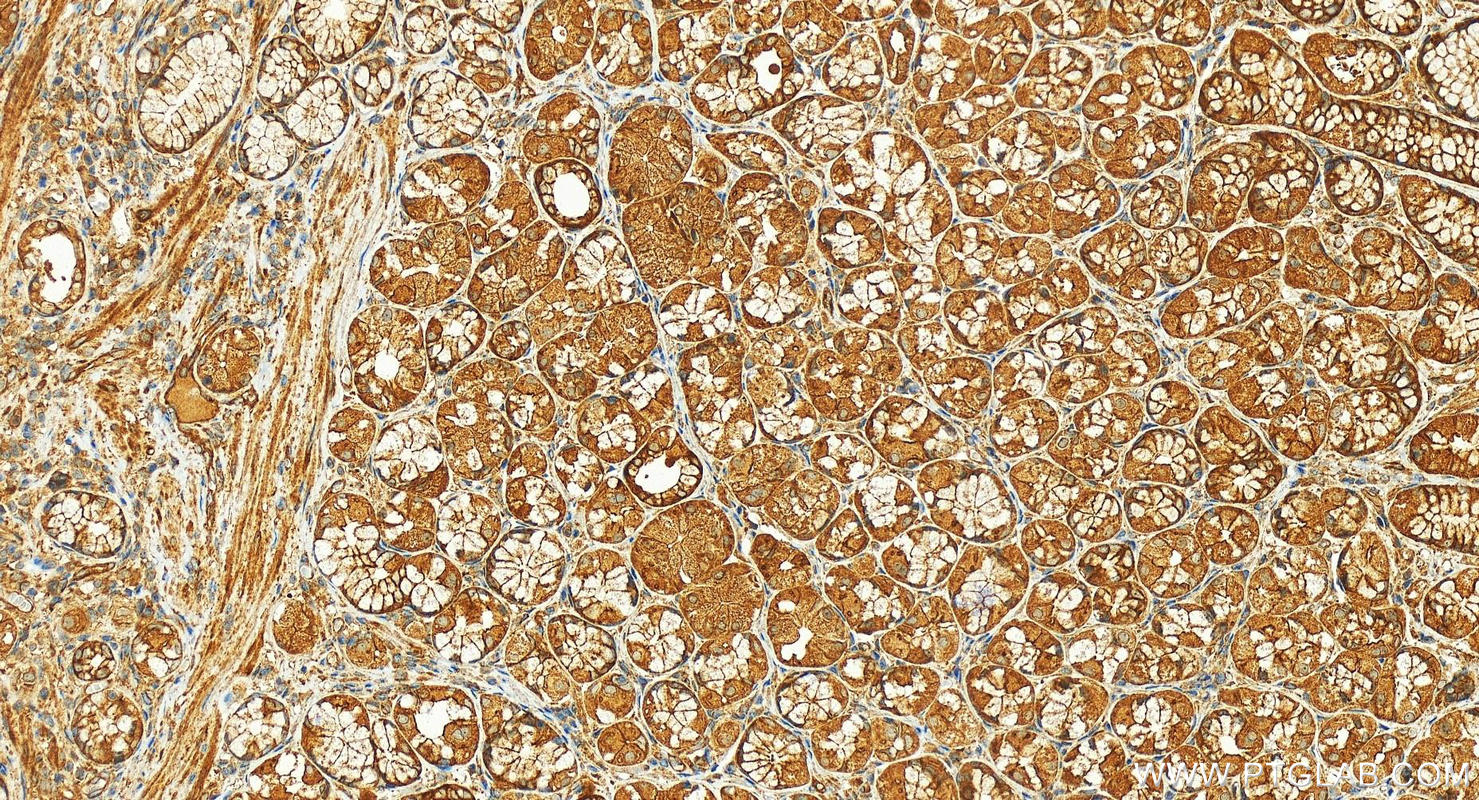 Immunohistochemistry (IHC) staining of human stomach tissue using Intersectin 1 Polyclonal antibody (21862-1-AP)