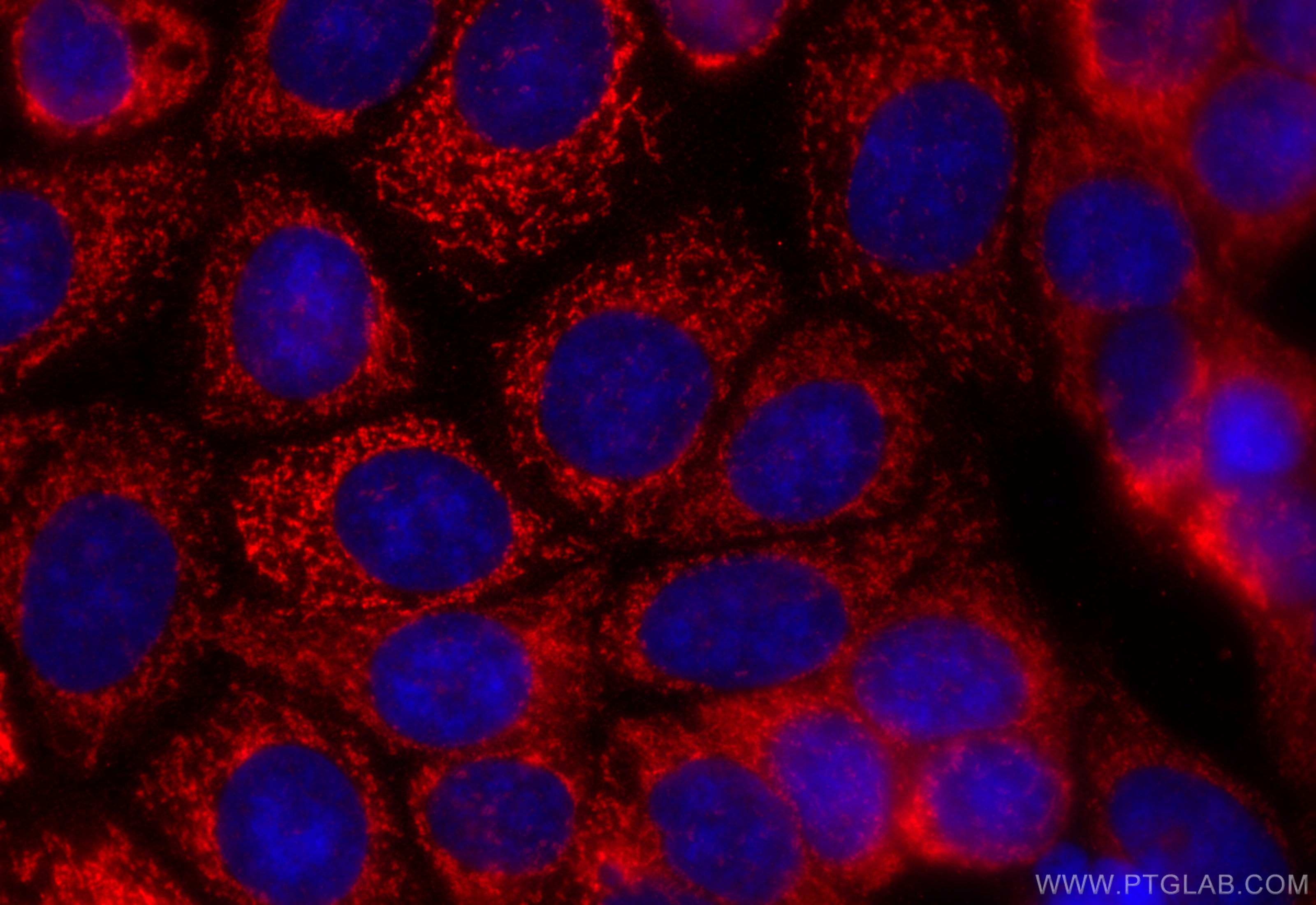 Immunofluorescence (IF) / fluorescent staining of MCF-7 cells using IVD Polyclonal antibody (10822-1-AP)