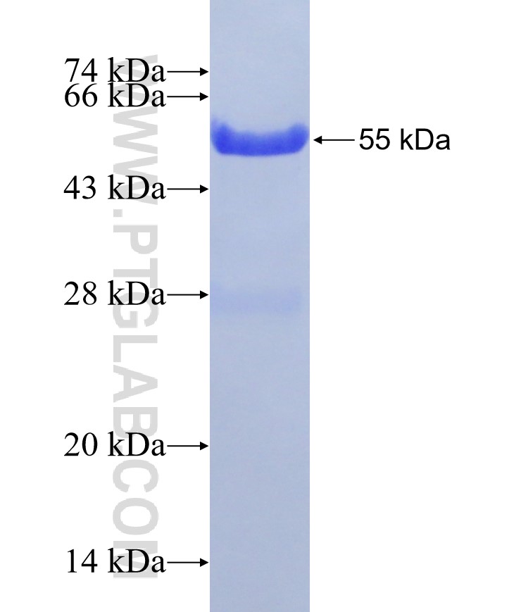 IVL fusion protein Ag31282 SDS-PAGE