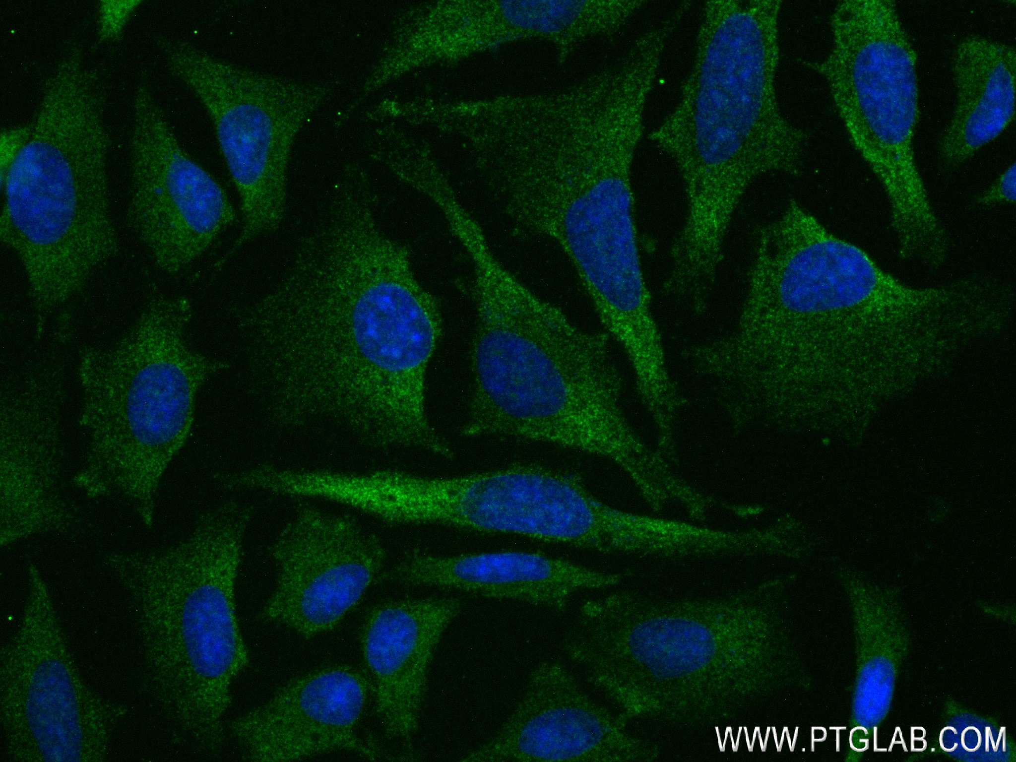 Immunofluorescence (IF) / fluorescent staining of HeLa cells using IVNS1ABP Recombinant antibody (84268-1-RR)