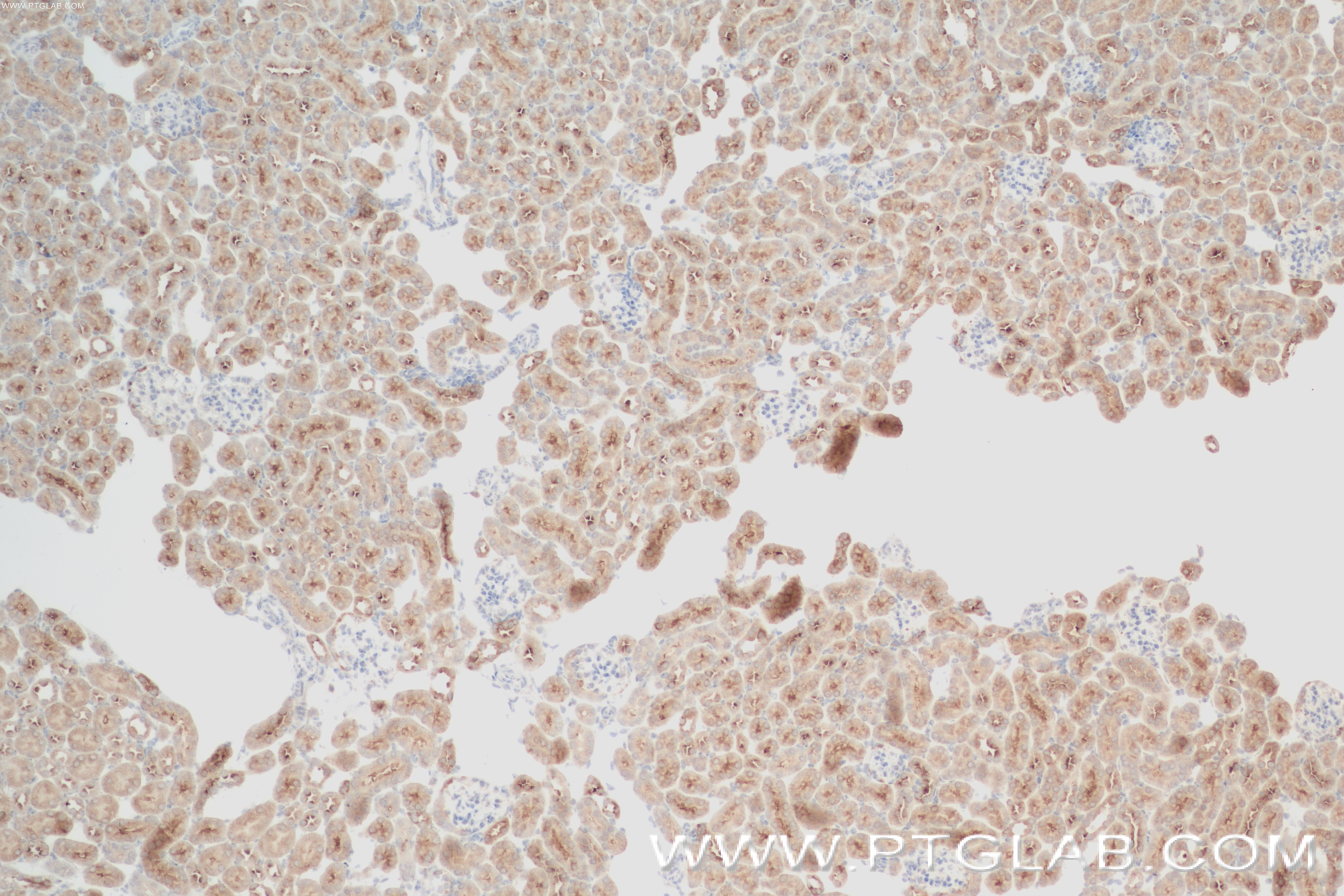 Immunohistochemistry (IHC) staining of mouse kidney tissue using IVNS1ABP Recombinant antibody (84268-1-RR)