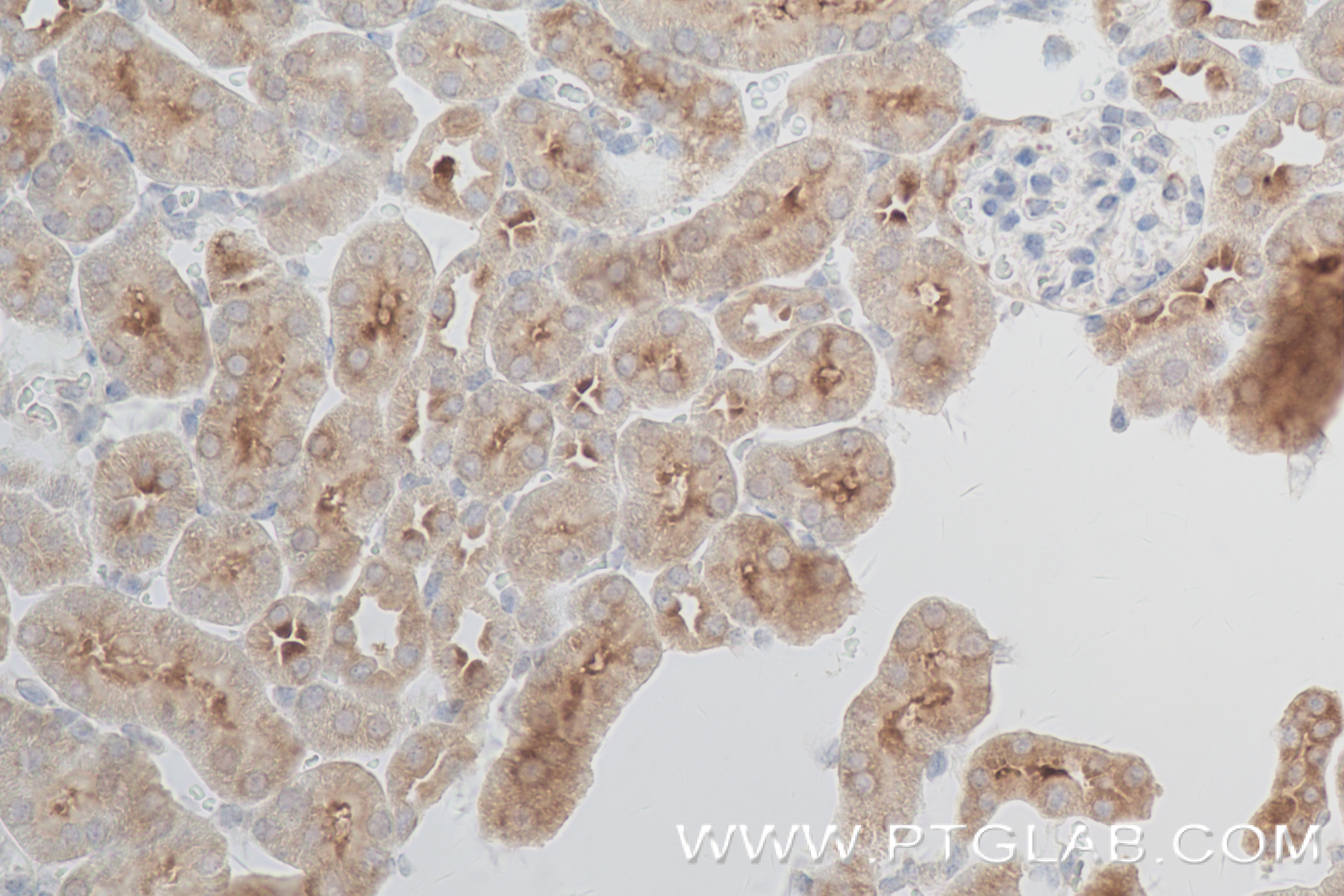 Immunohistochemistry (IHC) staining of mouse kidney tissue using IVNS1ABP Recombinant antibody (84268-1-RR)