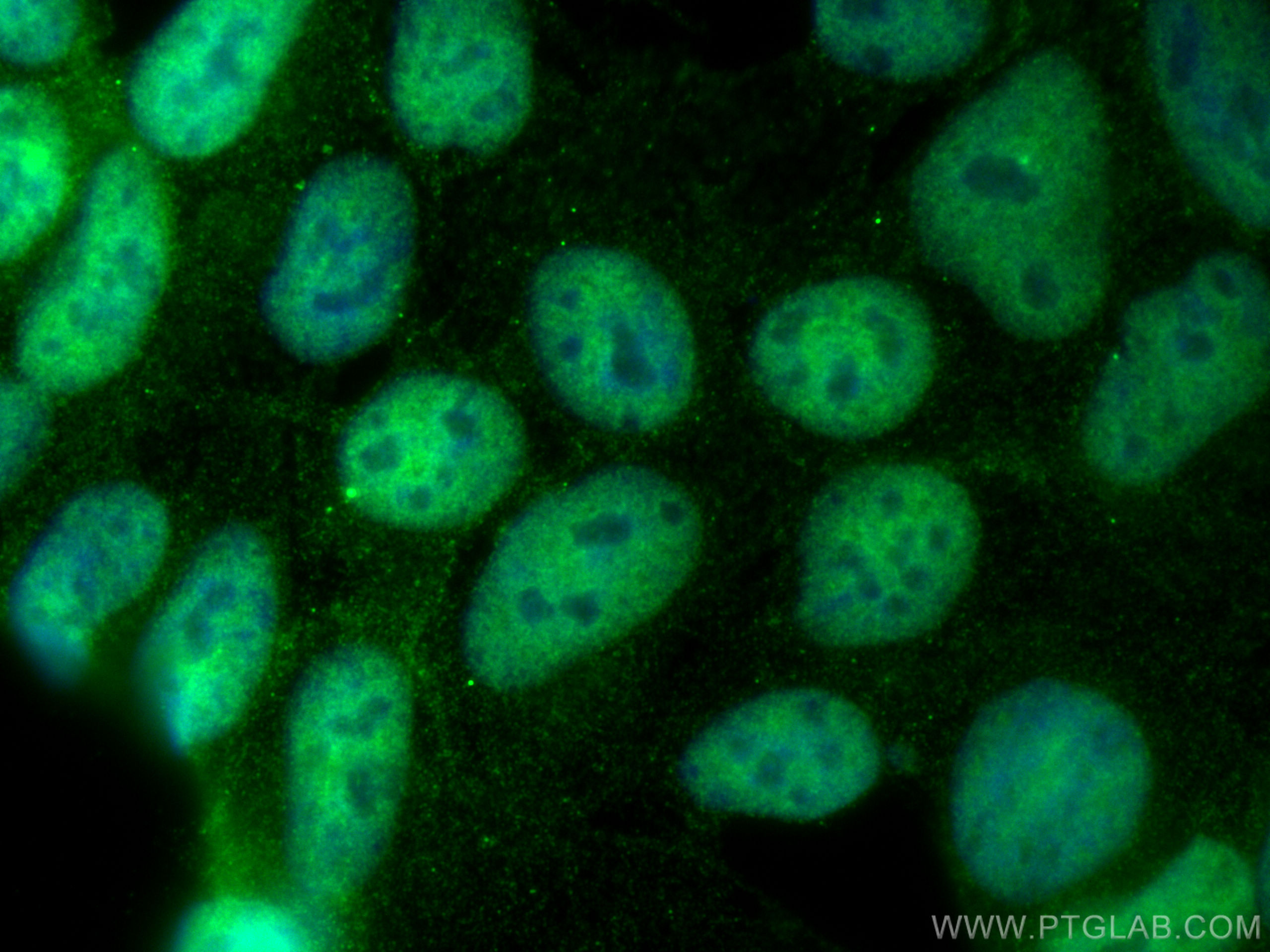 Immunofluorescence (IF) / fluorescent staining of HEK-293 cells using IWS1 Polyclonal antibody (16943-1-AP)